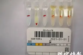 全球首个核苷酸序列！泰州发现罕见小p血型图片
