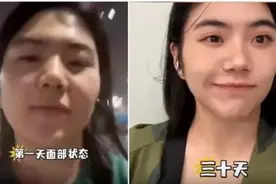 【早读】坚持30天就能像换了个人？这款运动才是隐藏的医美宝藏图片