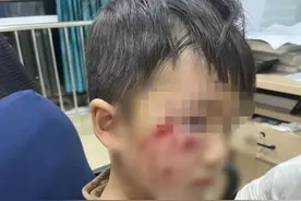 3岁男童被恶犬咬伤，打了疫苗后仍不幸离世！母亲：没找到狗主人图片