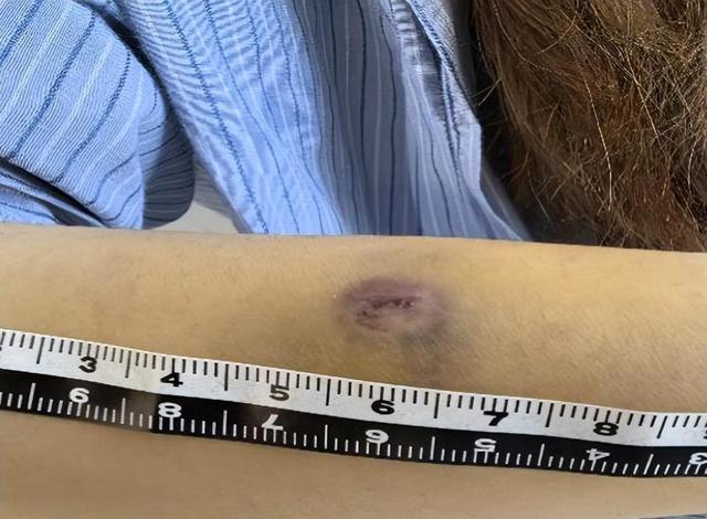 等红灯“无聊”，货车司机向路人射去钢珠！警方：4名伤者均为女性