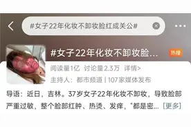 不敢见人！女子脸肿成关公，竟是因为睡前偷懒省了个步骤？这情况女性不少见图片