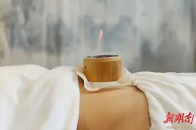 脐灸——这个冬天别错过它图片