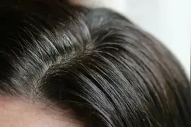 “黑发神器”不可轻信图片