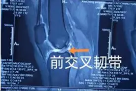 薛城区中医院：膝关节疼痛不再困扰，关节镜治疗显奇效图片