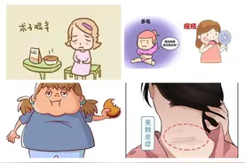 发病率高达5%以上，多囊卵巢综合征影响的不只是生育图片