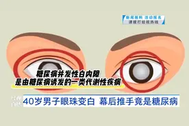 武汉40岁男子眼珠变白！检查发现这个指标严重超标……医生提醒：这类人群风险较高图片