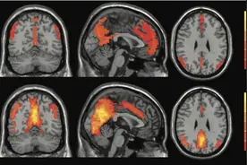 吃脑补脑？人脑只被开发了10%？这5个关于大脑的谣言，快别信了！图片