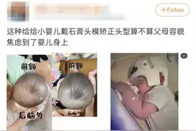 婴儿头型矫正“头盔”火了，到底有没有危害？图片
