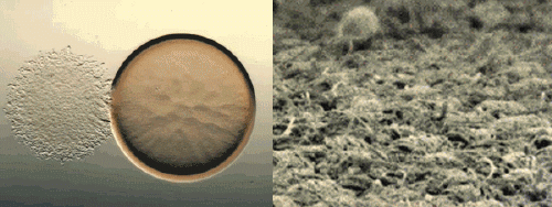 头上扣下来的白泥竟然是螨虫尸体！头痒头屑出油多，用TA就对了