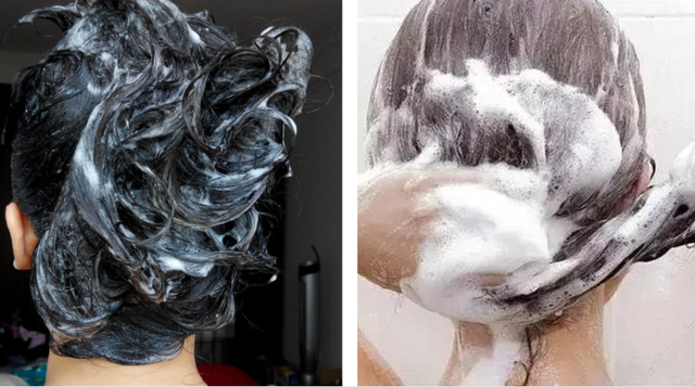 头上扣下来的白泥竟然是螨虫尸体！头痒头屑出油多，用TA就对了