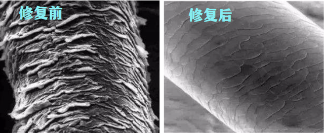 头上扣下来的白泥竟然是螨虫尸体！头痒头屑出油多，用TA就对了