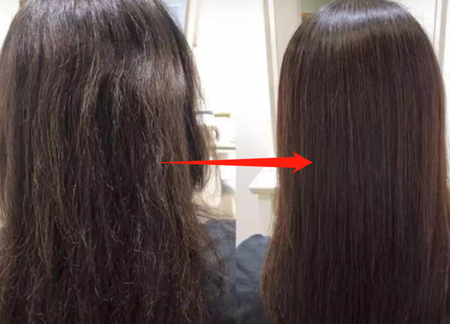 头上扣下来的白泥竟然是螨虫尸体！头痒头屑出油多，用TA就对了