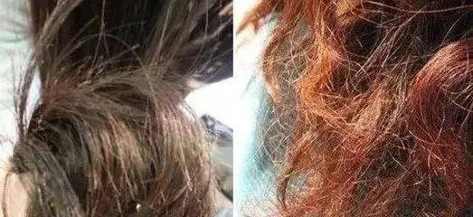 头上扣下来的白泥竟然是螨虫尸体！头痒头屑出油多，用TA就对了