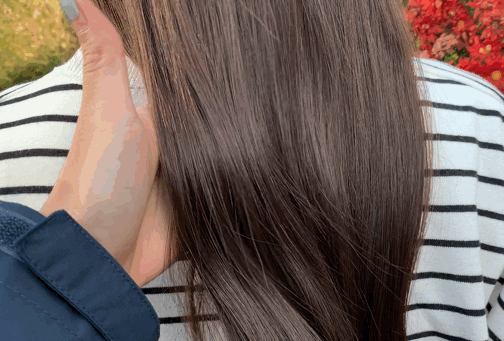 头上扣下来的白泥竟然是螨虫尸体！头痒头屑出油多，用TA就对了