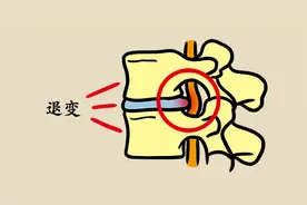 介绍 4 个保护颈椎的动作，锻炼起来，绝不向生活“低头”图片