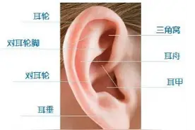 “招风耳”也是畸形的一种！新生儿耳廓畸形矫正宜早不宜迟图片