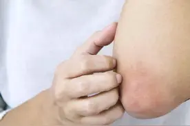 经常感觉身上有虫子在爬是怎么回事？医生：可能是这3种疾病视频封面