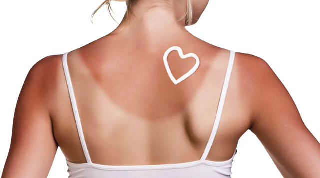 涂身体乳可以去鸡皮疙瘩吗 涂身体乳可以去鸡皮疙瘩吗