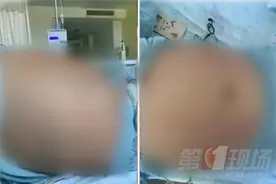 13岁女孩突然“发胖”，腹中竟隐藏巨大威胁！家长平时切勿大意图片