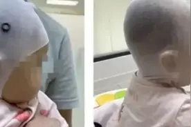 戴2.8万元“头盔”让婴儿头型变好看？！医生紧急提醒图片