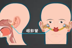 反复耳闷，当心咽鼓管功能障碍图片