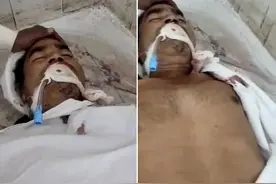 印度一男子被宣布“死亡”7小时后醒来！还在太平间冰柜待了一夜图片