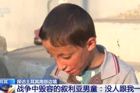 战争中毁容的叙利亚男孩：没人跟我一起玩图片