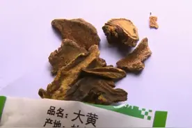 每天吞100粒小粉丸，27岁女子腹内积粪3公斤……图片