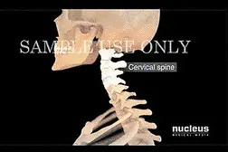 八成头痛和颈椎有关！一份“疼痛位置图解”帮你对症放松图片