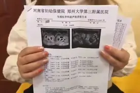怀八胞胎女子年仅18岁图片