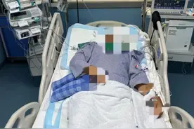 男子被生锈铁钉扎伤脚，ICU里住了近2个月图片