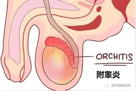 孩子说“蛋疼”，家长需要关注吗？图片