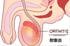 孩子说“蛋疼”，家长需要关注吗？图片