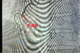 宁津县人民医院：亲历抢救现场 感受惊魂一刻图片