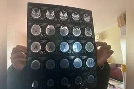 北京广场「舞王」跳完最后一支舞后猝死图片