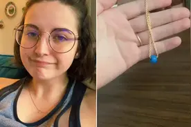 女子因疼痛检查发现鼻子里有一颗20年前的玩具珠子图片