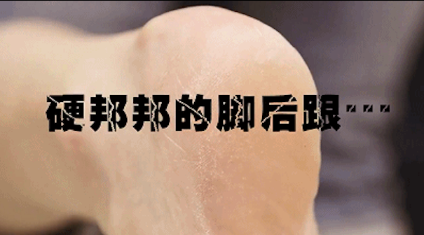 脚裂口子可以涂身体乳吗 脚裂口子可以涂身体乳吗