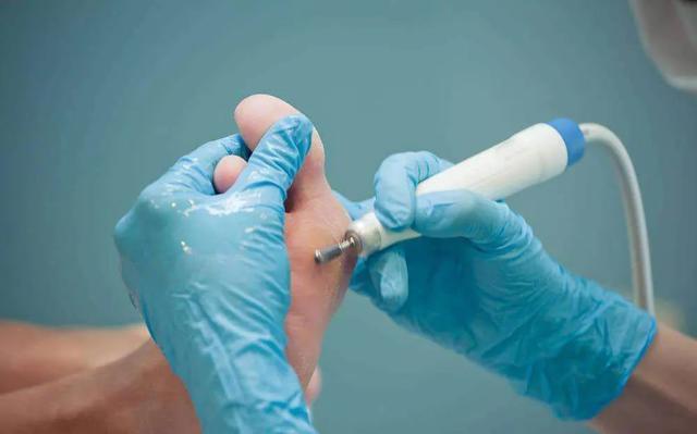 脚裂口子可以涂身体乳吗 脚裂口子可以涂身体乳吗