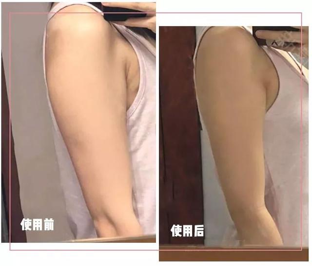 绌夸笂瀹冿紝璁╄禈鑲夆€滈€冪鈥? data-ratio=