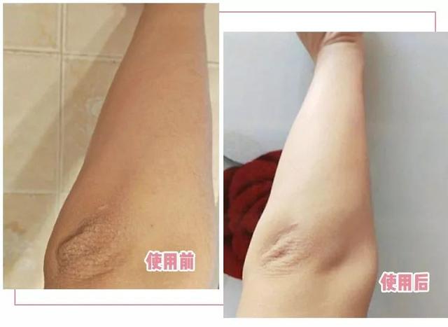 绌夸笂瀹冿紝璁╄禈鑲夆€滈€冪鈥? style=