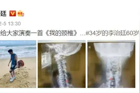34岁的演员颈椎骨龄已经60岁？保护颈椎真的是一辈子的事图片