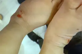 10月大婴儿被影楼道具草坪磨出血！店家：不硬的，孩子喜欢动图片