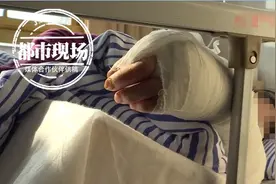 女子被它抓伤，10天后胳膊溃烂图片