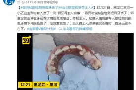 做完核酸检测把假牙丢了 业主群里假牙寻主人图片