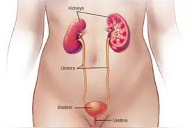 令人懊恼的尿路感染，怎么应对？图片