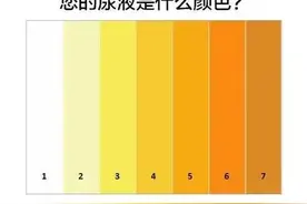 尿液出现这8种颜色要小心了，可能是疾病的信号图片