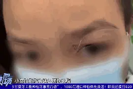 揪心！女童围观钓鱼，被飞来鱼钩“扎进”眼睛图片