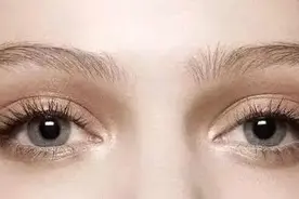 济南海峡整形科普：想要妈生款双眼皮，要这样做图片