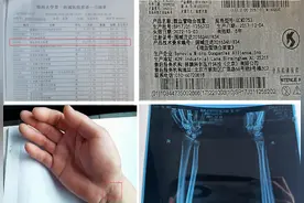 郑大一附院9患者付高价器材费却未被使用，医生：术中不适用裁除图片