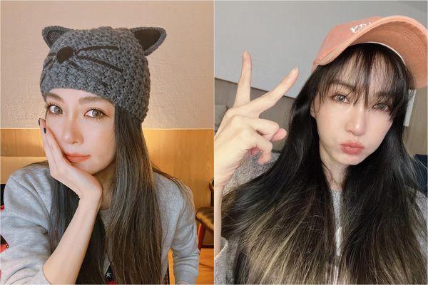 谢金燕跨年前夕「右眼肿 瘀青」!包纱布变独眼龙:姐又神预言